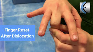 finger reset after dislocation you