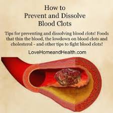 What kind of food is good for blood clots. Blood Clots