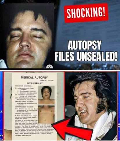 Elvis Presley autopsy report released