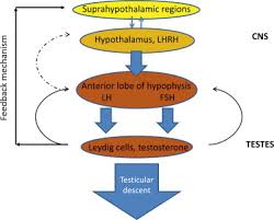 It is different from monorquismo, the condition of having only one testicle. Diagnosis And Management Of Cryptorchidism European Urology Supplements