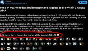 Nerves are so bad, it's part of my life.. Jack On Twitter This Dude Faked Brain Cancer For Karma On Reddit Smh