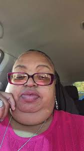 Onelove #Praisepusher #SarcoidosisWarrior @Sylvia Carroll #Share #Fyp