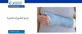 يد مكسوره كسر اليد علاج كسور اليد ذراع مكسورة الأسباب الأعراض ایرانیان سرجری