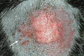 Maybe you would like to learn more about one of these? Acute Moist Dermatitis Clinician S Brief