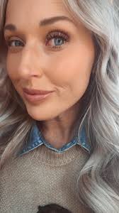 What a God!! #rescuestory #healed