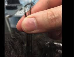 Image result for Hair Pull Test