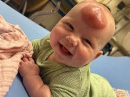 Fundraiser for McKenzie Bartoe by Madi Miller : Help Lilly's Journey to  Recovery