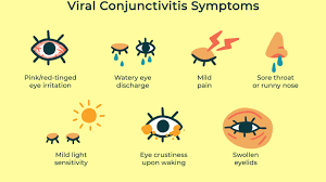 Viral Conjunctivitis: Treatment, Symptoms, And More
