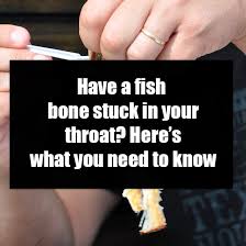 Have A Fish Bone Stuck In Your Throat Here S What You Need To Know