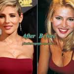 Schauspielerin elsa pataky feierte am wochenende ihren 45. Janet Jackson Plastic Surgery Before After Pics