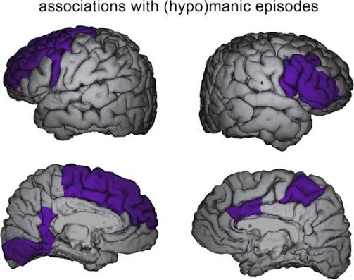 Mania-related effects on structural brain changes in bipolar disorder – a  narrative review of the evidence | Molecular Psychiatry