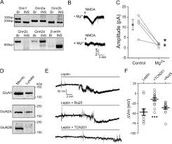 They make miniature kingdoms out of shredded paper, feast on 'giant' food scraps (like grapes), and go on wild escapades whenever they leave their cages. Leptin Modulates Pancreatic B Cell Membrane Potential Through Src Kinase Mediated Phosphorylation Of Nmda Receptors Journal Of Biological Chemistry