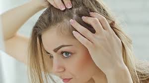 Da đầu nổi cục là do đâu? Cách điều trị như thế nào?