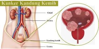 Ginjal merupakan organ yang terpenting dalam memepertahankan homeostasis dengan mengatur volume cairan,keseimbangan osmotik sistem perkemihan adalah suatu sistem yang didalamnya. Saluran Yang Membentang Dari Kandung Kemih Sampai Meatus Uretra Adalah Brainly Co Id