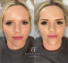 Lips I originally tattooed in 2023 and how they look today 🌻