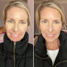 What is the name of yellowish eye color?