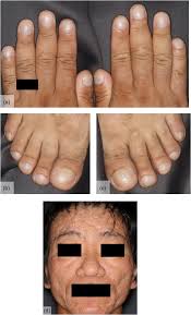 Image result for Digital Clubbing