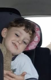 Does facial droop occur in children with seizures?