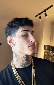 Preenchimento Mandibular #harmonizacaoorofacial #preenchimentomalar