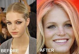 Erin Heatherton Nose Job Before After Nose Job Rhinoplasty Surgery Bad Plastic Surgeries