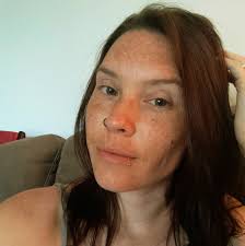 There is something going around, so I've been hearing, has anyone else been  sick recently or heard of this? If so what are/have been your symptoms?  We've experienced different issues with this