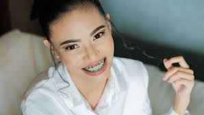 Lingual Braces: Efficacy, Cost & Comparisons | Byte®
