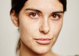 Behind the Mega Rise of Chin Makeovers