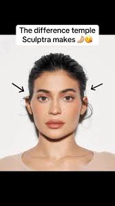 Love me some biostim to the temples 😍, ., ——————————————————-, BOOK WITH  US👇🏻👇🏻👇🏻, FORTE FACES INC. , 📱 267-638-5361 , 📧  Info@fortefaces.com, 🧷 Booking link in bio , ——————————————————-, Sara ...