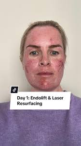 Tips for Wallpapering a Ceiling Like a Pro