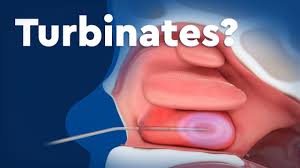 If the polyps grow large enough then they can begin to cause some unwelcome symptoms. Nasal Obstruction Children S Hospital Colorado