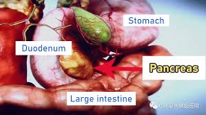 Selain itu, pankreas juga berfungsi sebagai penghasil hormon insulin yang berguna menyeimbangkan kadar gula darah dalam tubuh. Banyak Orang Mengira Sakit Mag Namun Ternyata Kanker Pankreas Kenali Gejala Gejala Ini æš¨å—å¤§å­¦é™„å±žå¤å¤§è‚¿ç˜¤åŒ»é™¢