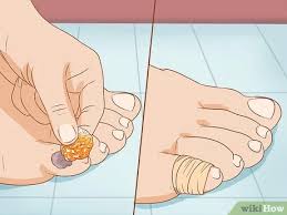 We did not find results for: 5 Ways To Treat A Blood Blister Wikihow