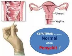Keputihan dengan lendir berwarna merah. Cara Mengatasi Keputihan Bercampur Darah