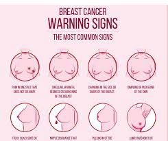 But just because some symptoms are more well known, doesn't mean lumps are not the only breast changes to tell the doctor about. Early Warning Signs Of Breast Cancer Woodlands Limited Facebook