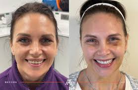 Patient Transformations