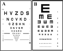 comparison of e chart and etdrs chart nidek chart projector