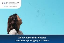 Image result for Floaters