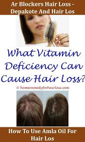 Common side effects of depakote include drowsiness, dizziness, nausea, vomiting, indigestion, diarrhea, weight loss, tremors, and skin reactions such as hair loss, rash, itching, and sensitivity to sunlight. Pin On Hair Loss Info