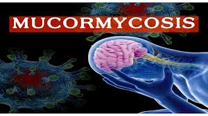The fungus can kill up to half those infected and attacks those with compromised immune systems. Oajbrvqdmsg6wm