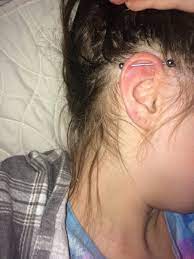 Industrial Piercing Hey This Is After A Year Got So Much Better I