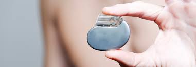 A case series and literature review. Icd Weniger Defi Implantationen Durch Bessere Patientenselektion Medical Tribune