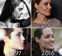 Angelina Jolie Chin Before And After Photo Angelina Jolie Nose Job Angelina Jolie Nose Angelina Jolie Plastic Surgery