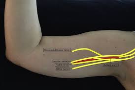Image result for Axillary Nerve Block