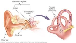 Image result for Canalith Repositioning Procedure