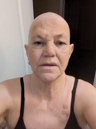 Loving my Adli find. #cancersurvivor Thank you all so much for your kind  words. Loosing my hair, my skin darking from chemo and dealing with my  weight. I've kinda used shopping as