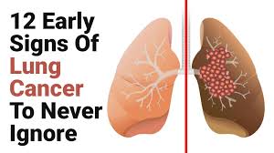 Those who smoke have higher chances of developing cancer than those who do not. 12 Early Signs Of Lung Cancer To Never Ignore