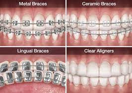 Here are some factors that can impact. Kenia Dental Clinic