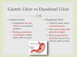 Ulcer diet what to eat for better management. Drknowledge Duodenal Ulcer Vs Peptic Ulcer Facebook