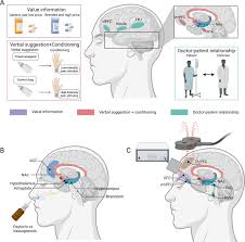 Image result for Placebo Effect