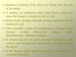 Breast cancer is cancer that develops from breast tissue. Breast Cancer Ppt Download